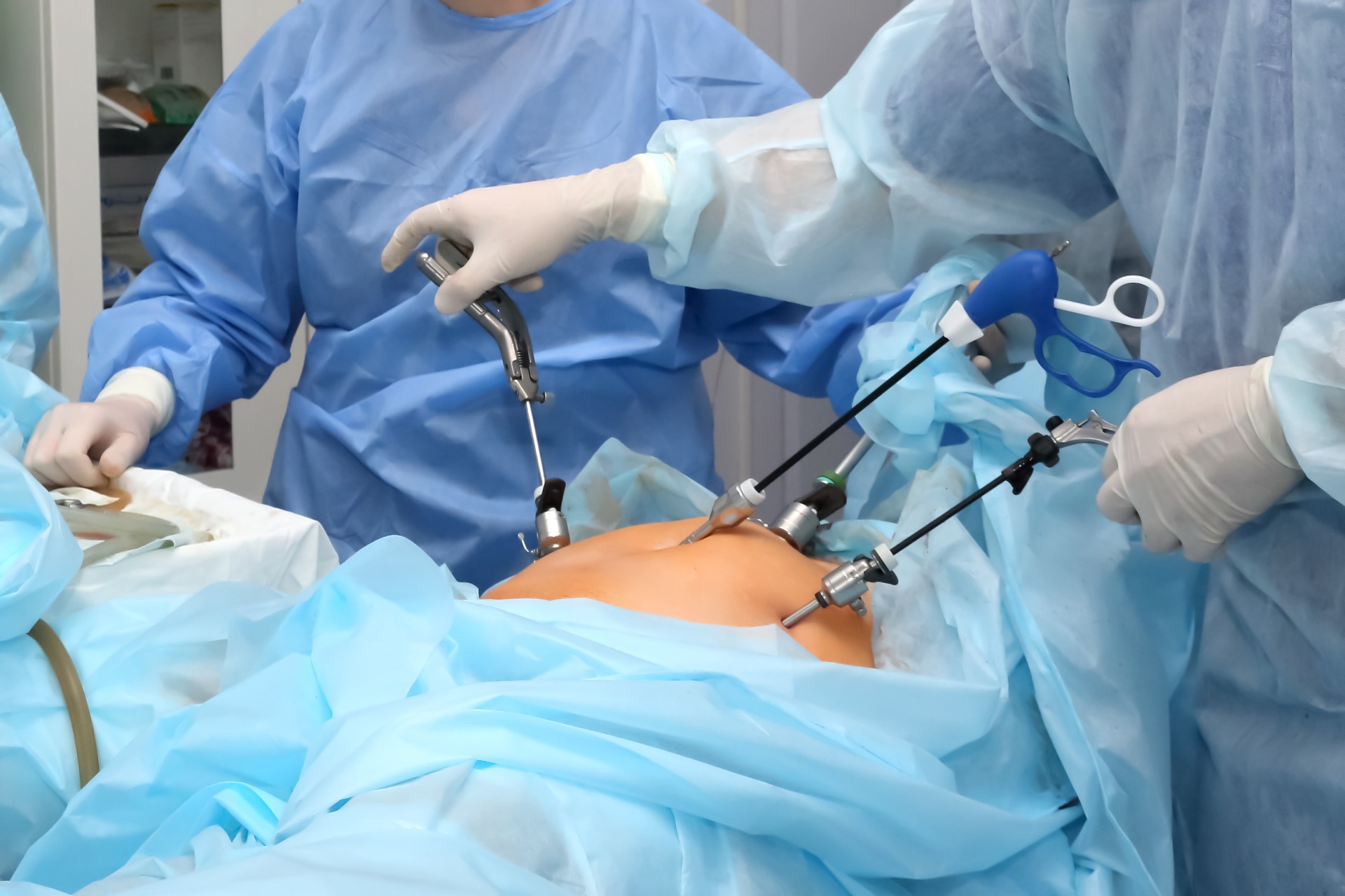 operation-stomach-medical-procedure-treating-patient-with-surgical-intervention-operating-room